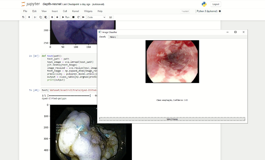 Polyp SC2