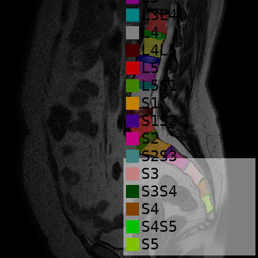 spine_annotated